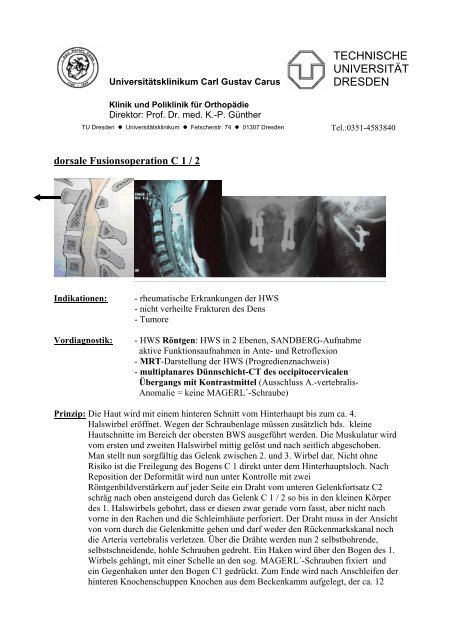 dorsale Fusionsoperation C 1 / 2 - Universitätsklinikum Carl Gustav ...