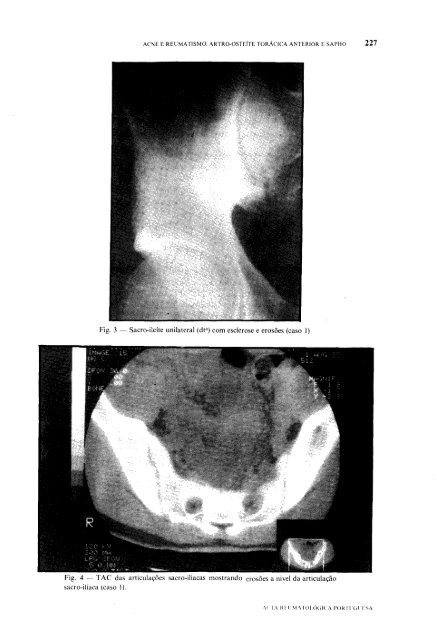 1989 Volume XIV, 4, 4º Trimestre - Acta Reumatológica Portuguesa ...
