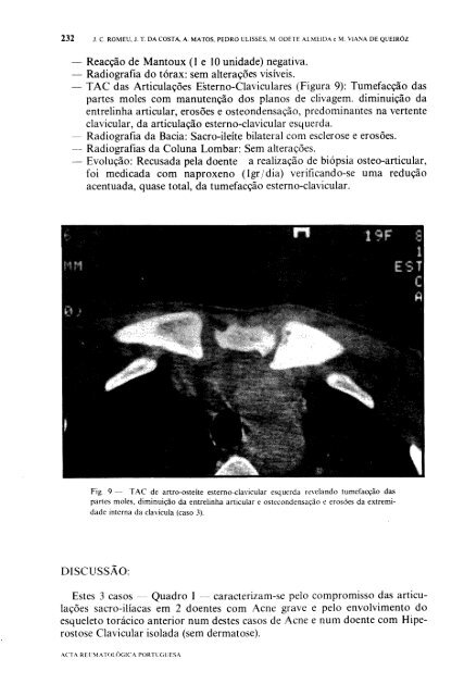 1989 Volume XIV, 4, 4º Trimestre - Acta Reumatológica Portuguesa ...