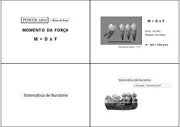 M = D x F M = D x F Sistemática de Burstone