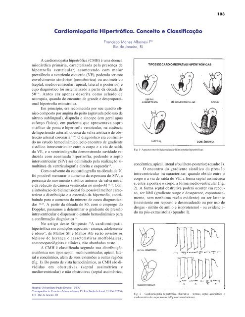 Corte transversal dos ventrículos, com evidente hipertrofia do