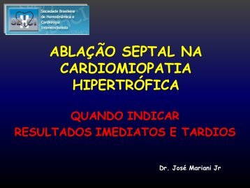Ablação septal na cardiomiopatia hipertrófica obstrutiva - SBHCI