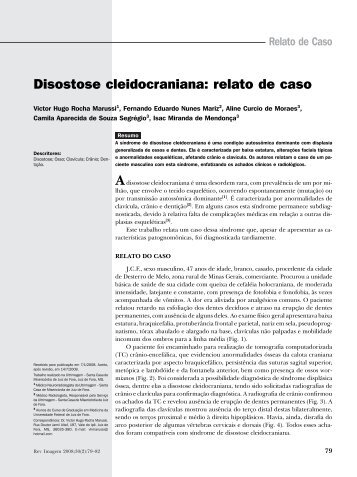 disostose cleidocraniana.pmd - SPR