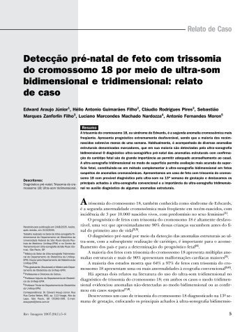 Detecção pré-natal de feto com trissomia do - SPR