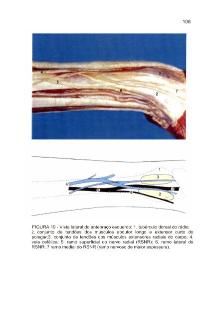 rosemari baccarelli estudo do ramo superficial do nervo radial ...