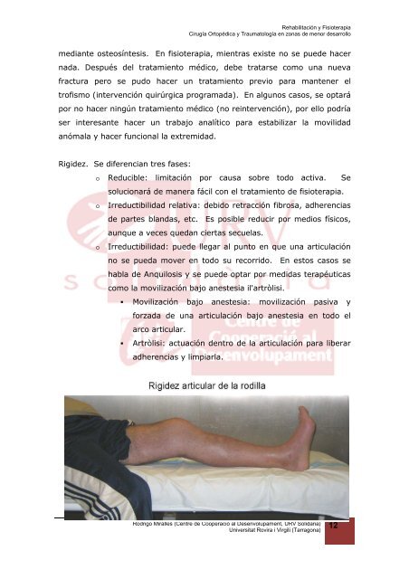 7.4. Fisioterapia en el tratamiento de las fracturas - Universitat ...