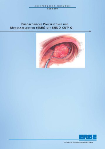 mit endo cut® q. -  Wieser Medizintechnik