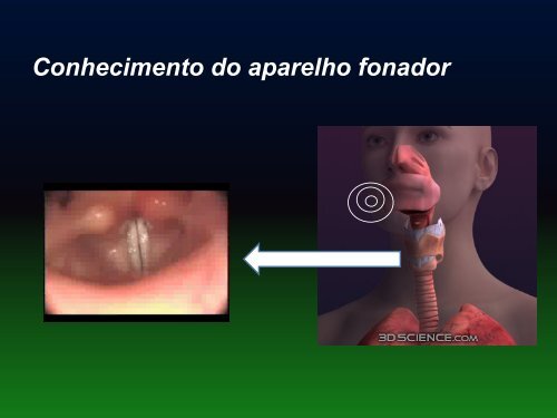 DISTÚRBIOS DA VOZ - ANAMT