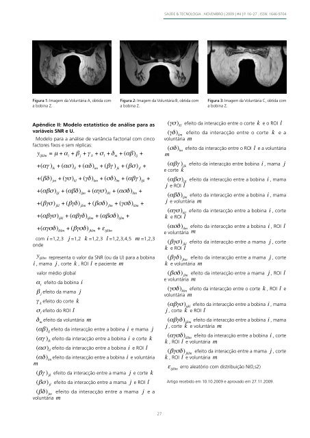 Bobinas de radiofrequência em estudos mamários por ressonância