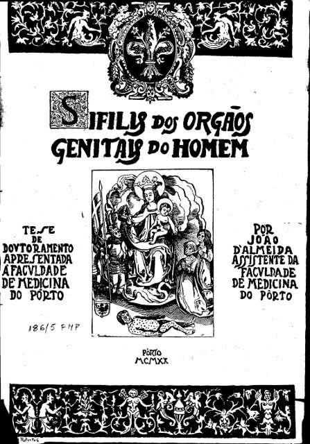 prostata 45 mlp