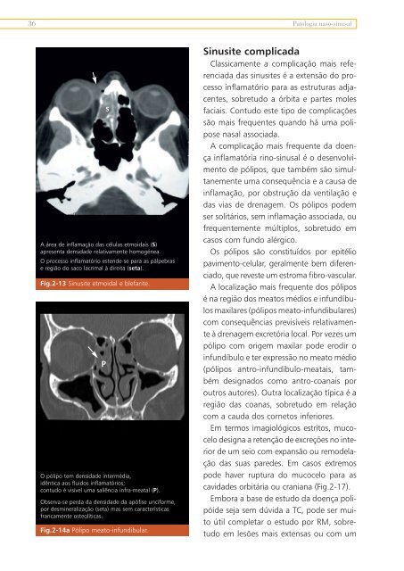 Livro Patologia Naso-sinusal.pdf - Repositório do Hospital Prof ...