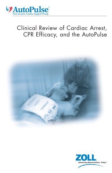 AutoPulse White Paper.pdf(2.2Mb) - ZOLL Medical Corporation