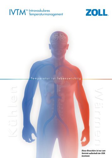 Intravaskuläres Temperaturmanagement - ZOLL Medical Corporation