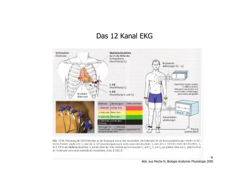 Typische EKG-Veränderungen erkennen - Zollernalb Klinikum gGmbH