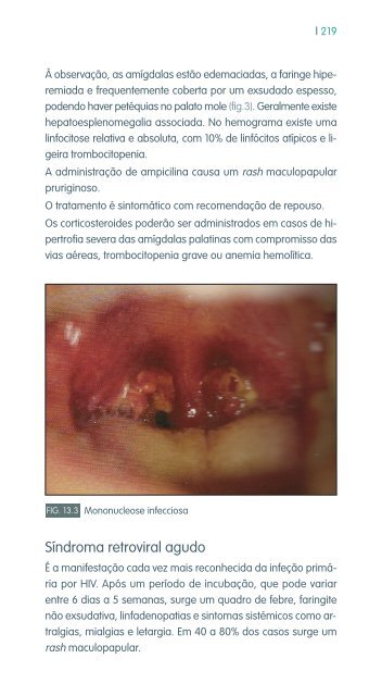 faringe e laringe - Repositório do Hospital Prof. Doutor Fernando ...