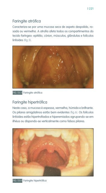 faringe e laringe - Repositório do Hospital Prof. Doutor Fernando ...