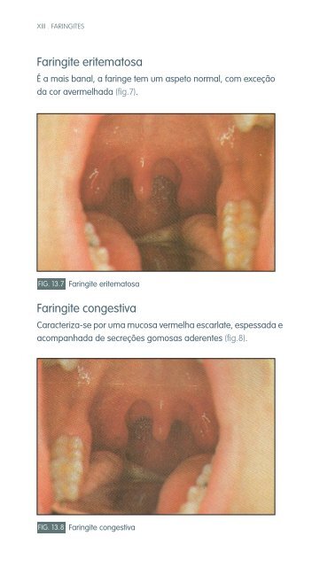 faringe e laringe - Repositório do Hospital Prof. Doutor Fernando ...