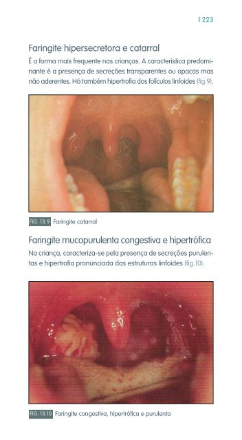 faringe e laringe - Repositório do Hospital Prof. Doutor Fernando ...