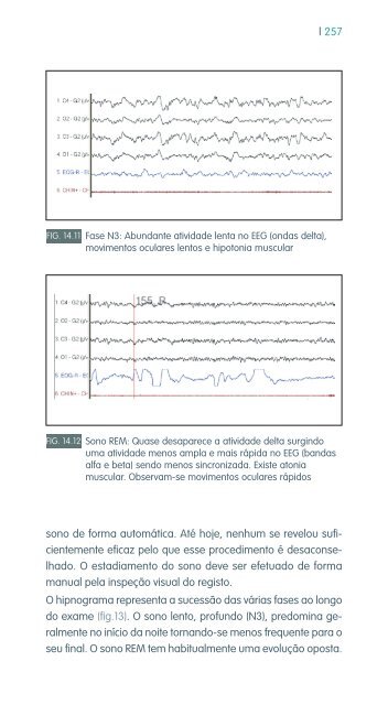 faringe e laringe - Repositório do Hospital Prof. Doutor Fernando ...