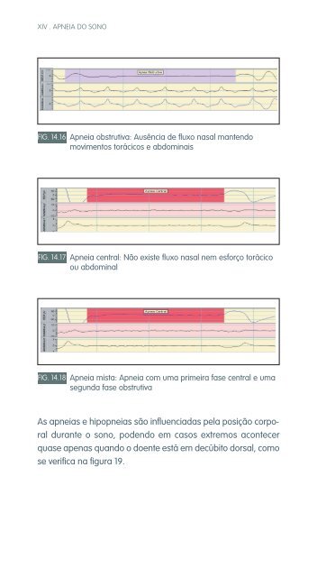 faringe e laringe - Repositório do Hospital Prof. Doutor Fernando ...