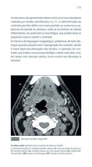 faringe e laringe - Repositório do Hospital Prof. Doutor Fernando ...