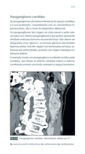 faringe e laringe - Repositório do Hospital Prof. Doutor Fernando ...