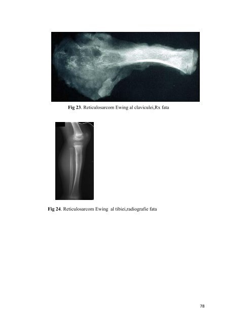 curs electronic - OvidiusMD