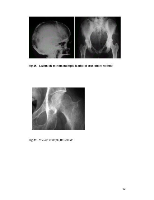 curs electronic - OvidiusMD