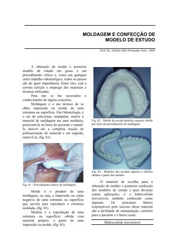 MOLDAGEM E CONFECÇÃO DE MODELO DE ESTUDO