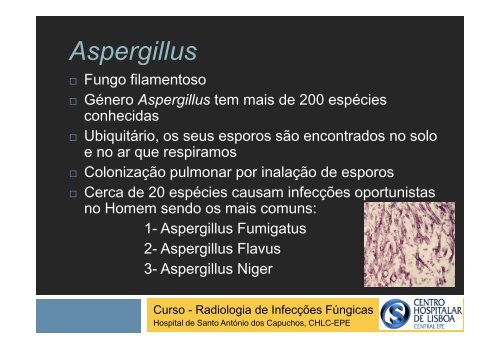 Aspergilose