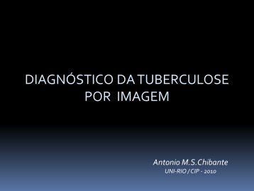 DIAGNÓSTICO DA TUBERCULOSE POR IMAGEM