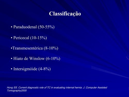 Hérnias Internas