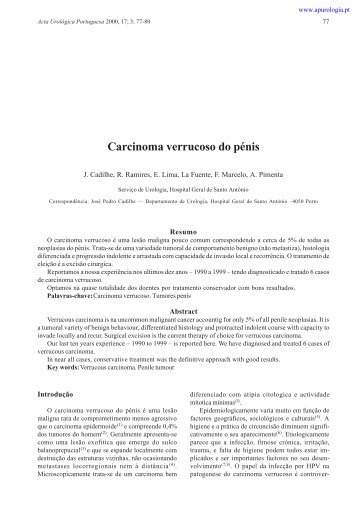 Carcinoma verrucoso do pénis - Associação Portuguesa de Urologia