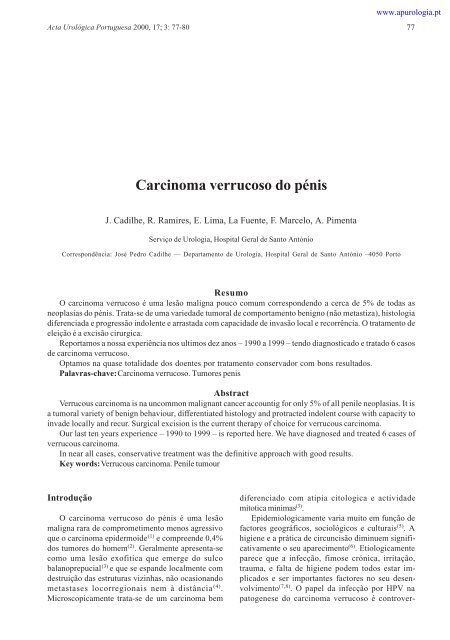 Carcinoma verrucoso do pénis - Associação Portuguesa de Urologia