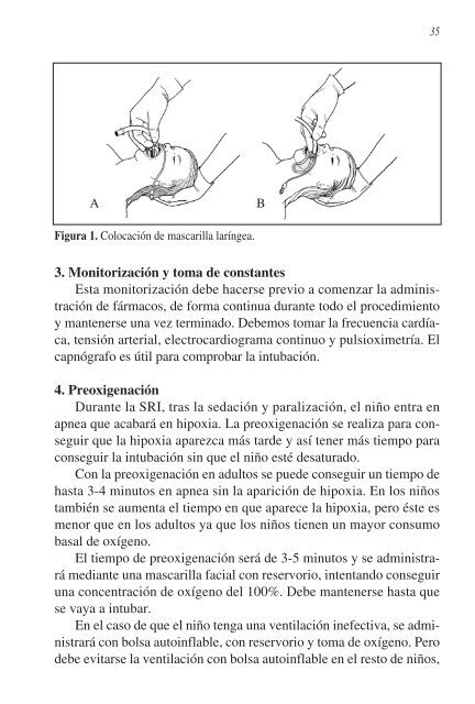 secuencia rápida de intubación - Urgencias de Pediatría