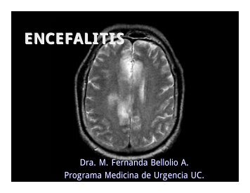 ENCEFALITIS - Medicina de Urgencia UC