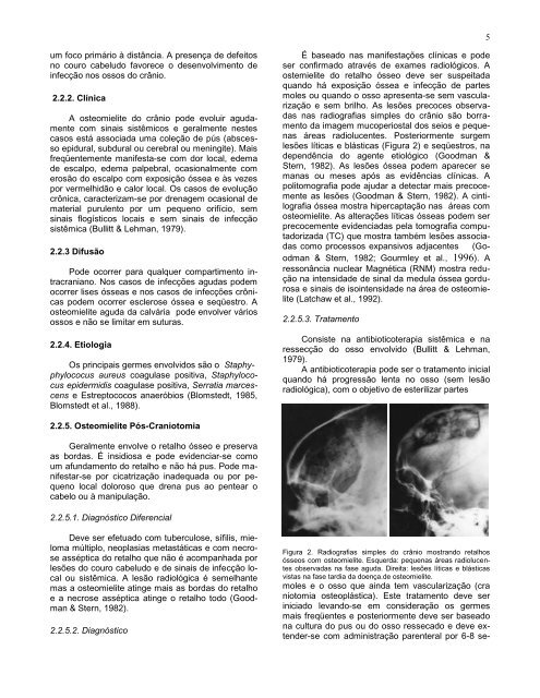 Complicações cirúrgicas das infecções bacterianas intracranianas