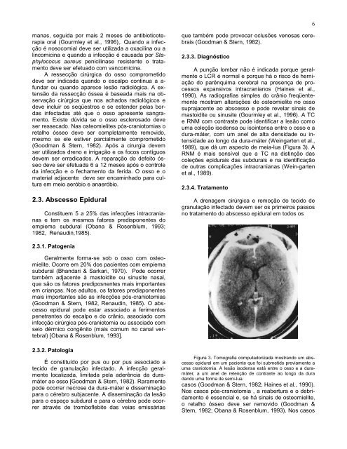 Complicações cirúrgicas das infecções bacterianas intracranianas