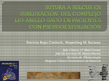 sutura a sulcus en subluxación del complejo lio-anillo ... - FacoElche