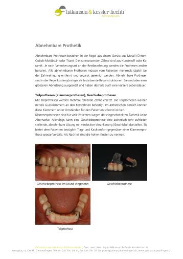 Abnehmbare Prothetik - zahnarztkonolfingen.ch