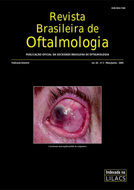 Como Funciona o Olho - Clínica de Oftamologia Macruz - Cirugias da