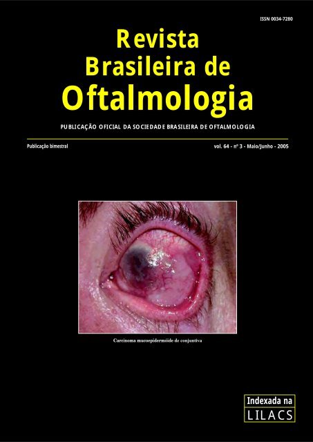 Como Funciona o Olho - Clínica de Oftamologia Macruz - Cirugias da