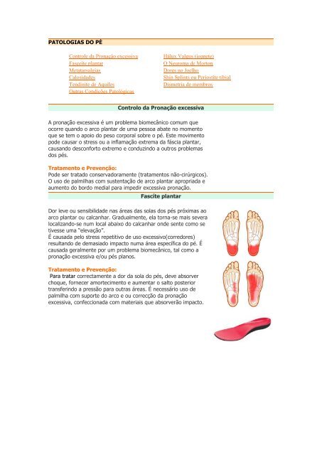 Dormência pés flip-flops nos causar pode