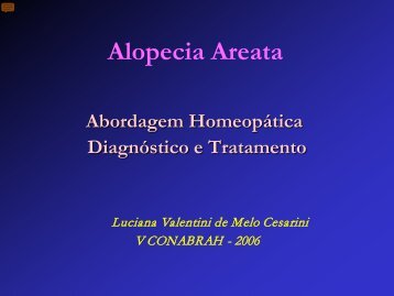 Alopecia areata x Homeopatia