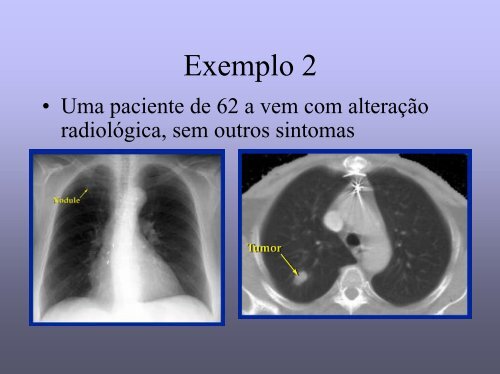 Gradação Histológica de tumores - medicina | celular