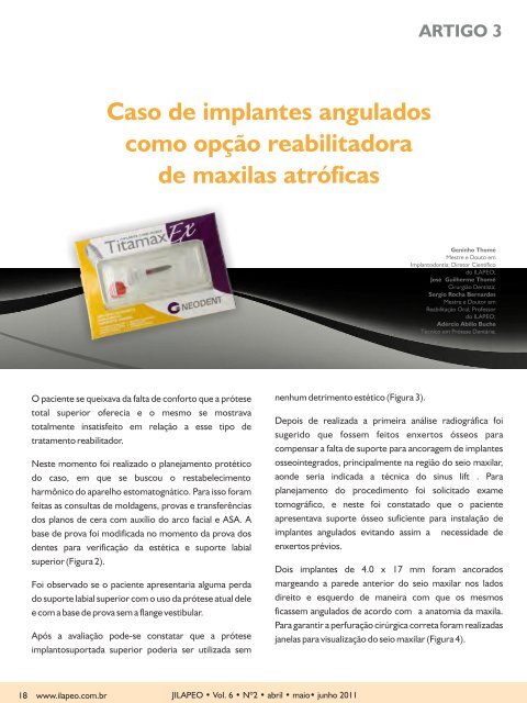 Caso de implantes angulados como opção reabilitadora ... - ILAPEO