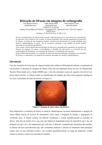 Detecção de Drusas em imagens de retinografia - deetc
