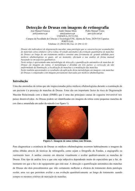 Detecção de Drusas em imagens de retinografia - deetc