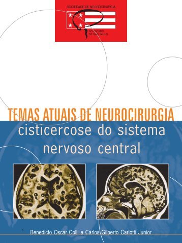 Temas Atuais de Neurocirurgia: Cisticercose do Sistema Nervoso ...