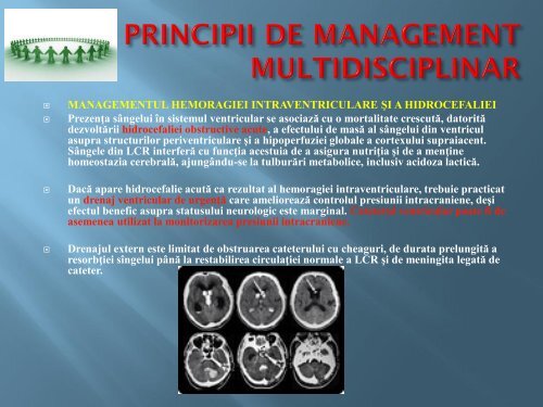 managementul chirurgical al stroke-ului hemoragic de fosa craniana ...